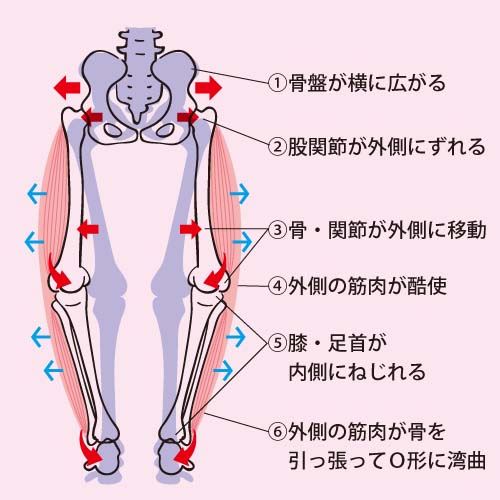 骨盤矯正 ｏ脚治し方ガイド